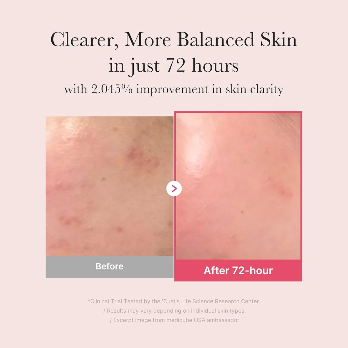 Medicube TXA+Niacinamide 15% Glow Facial Serum