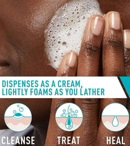Acne Foaming Cream Cleanser